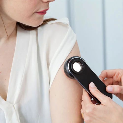 A doctor examining a patient’s skin with a dermatoscope